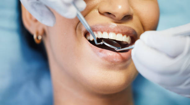 Best Chipped Tooth Repair Near Me  in Muscoda, WI