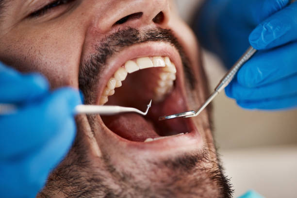 Emergency Dentist for Kids in WI